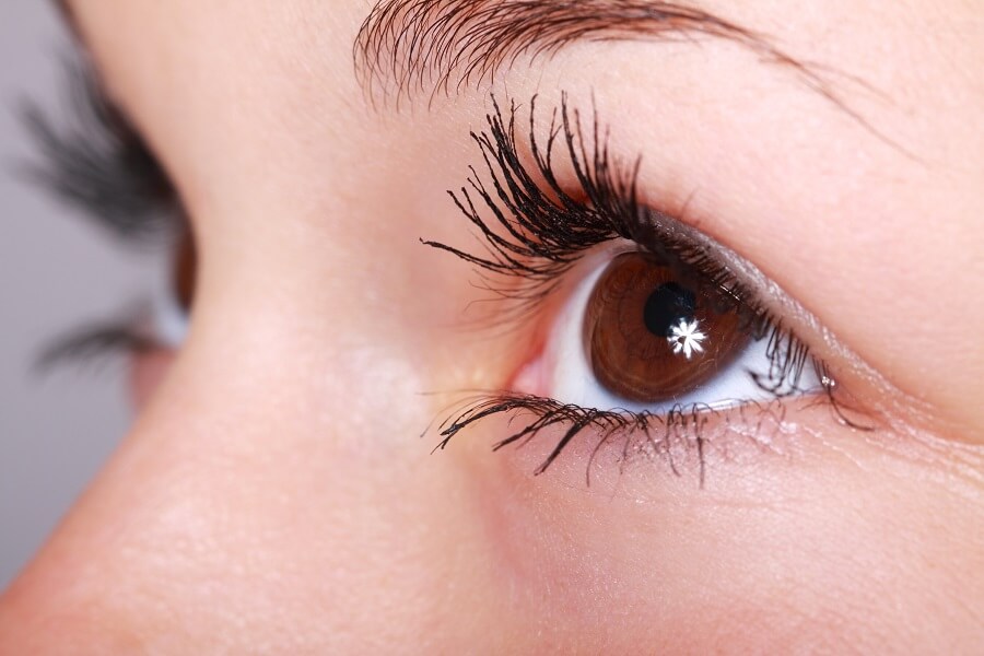 blepharoplasty by Dr. Ali Soueid, showing rejuvenated upper and lower eyelids with reduced puffiness and skin laxity.
