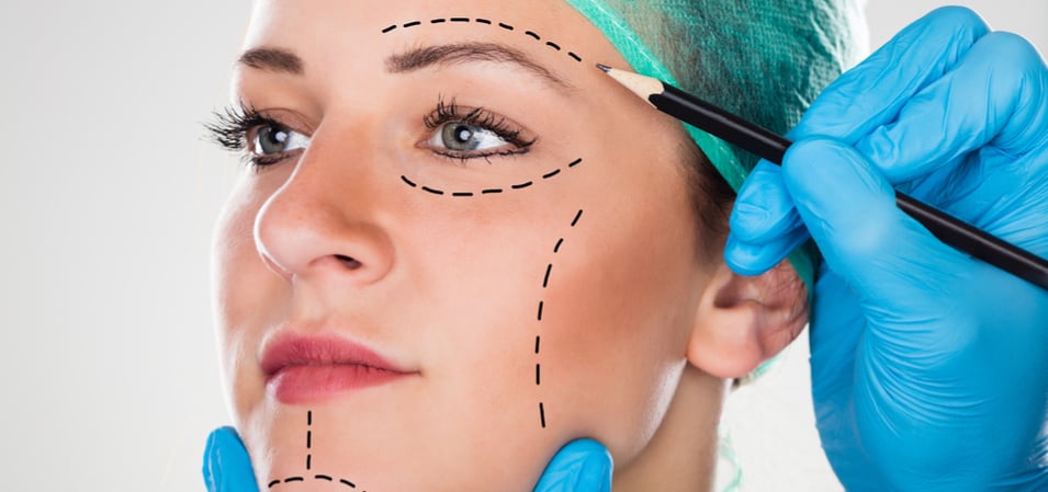 Side-by-side comparison of facial anatomy affected by SMAS and deep plane facelift techniques.