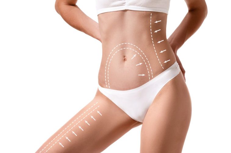 Comparison chart of popular liposuction machines including VASER, MicroAire, and BodyTite used by Dr. Ali Soueid in Qatar, UAE, and London.
