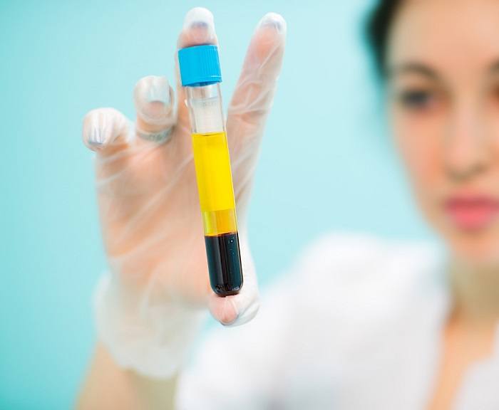 “PRP therapy by Dr. Ali Soueid – illustration showing platelet-rich plasma injection for facial rejuvenation and hair restoration in London, Dubai, Doha, and Beirut.”