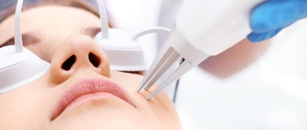 Laser Qatar hair removal