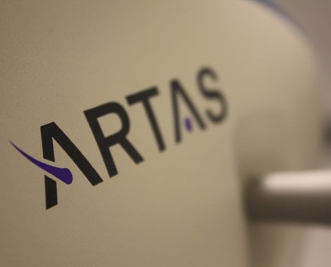 ARTAS hair restoration