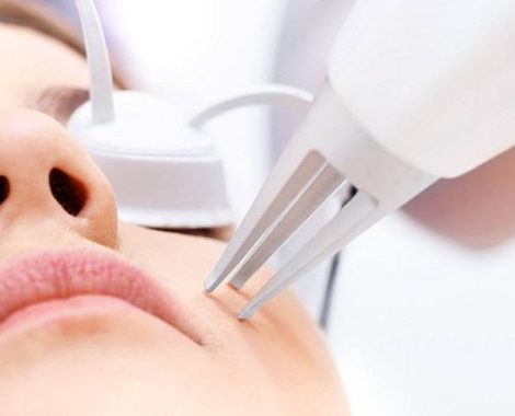 Laser Qatar hair removal